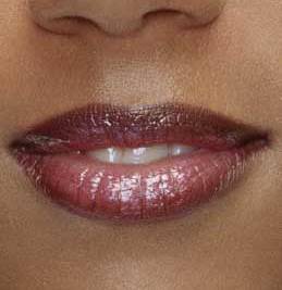 Dark Upper Lip – Causes of Dark Skin on Upper Lip Shadow, Line, Pigment, Treat