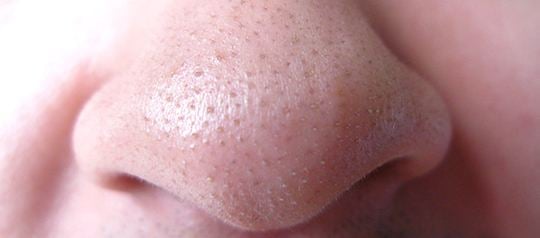 Big pores on your nose can easily form blackheads