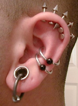 Ear piercings could cause keloids to form