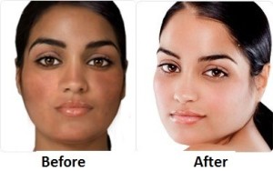 Best Skin Lightening Pills - Ivory Caps Before and After Photos