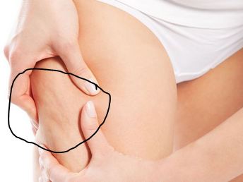 What is the best anticellulite cream with caffeine and Retinol