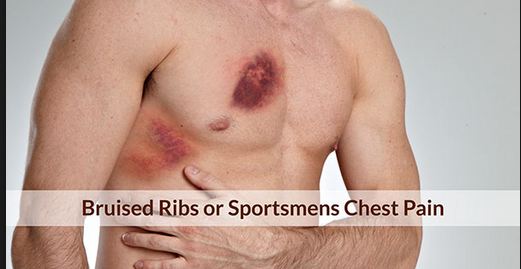 Symptoms of a bruised lung. Seek treatment.
