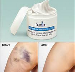 bruise relief cream - TriDerma