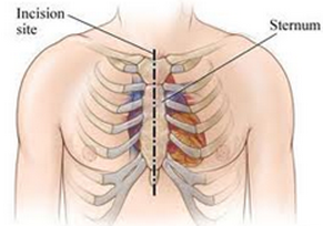 bruised sternum diagnosis