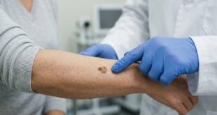 Skin Changes Deserve Timely Attention From a St. George Dermatologist
